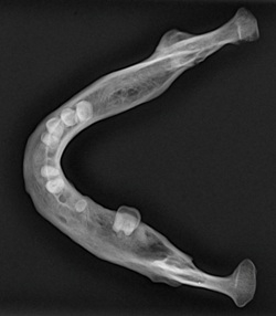 Mandible radiograph